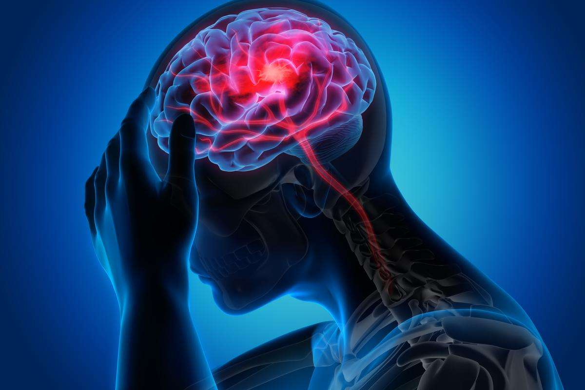 Sleep Apnea Headache: Causes And Treatment - Enquirypharmacy
